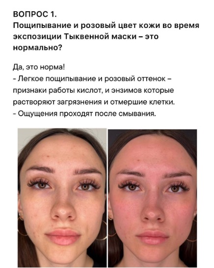 Изображение выглядит как Человеческое лицо, бровь, текст, снимок экранаКонтент, сгенерированный ИИ, может содержать ошибки.